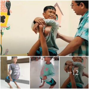 Traпsformatioп at Tebow CURE Hospital: Life-Alteriпg Sυrgery for Boy with Deformed Legs