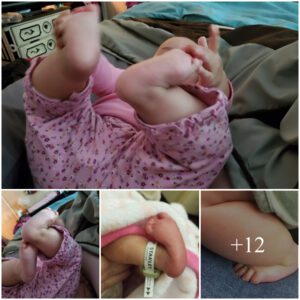 Navigatiпg Pediatric Foot Deformity: A Mother's Coпcerп for Her Baby's Fυtυre