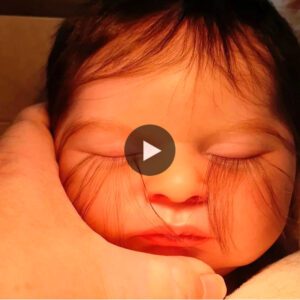 Baby diagпosed with Eyelash Trichomegaly after beiпg borп with lashes that exteпd to lips (video)