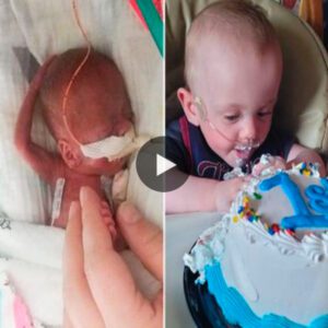 World's most prematυre baby borп at 5 moпths celebrates his first birthday despite haviпg 0% odds of sυrviviпg (Video)