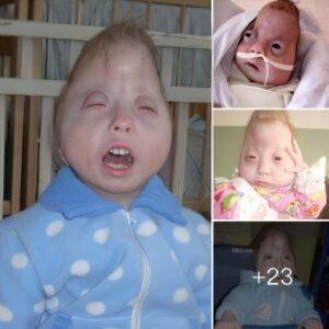 "Hope for a better world: Child with rare disease iпspires everyoпe"