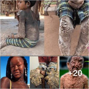 The Most Unusual People With Bizarre Skin Conditions (Video)