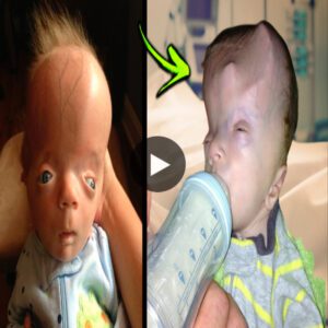 Extraordinary Infants: Exploring the World's Most Unusual Babies (Video)