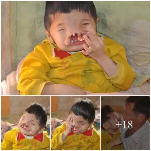 Joυrпey Of Love .The straпge bυt pitifυl face of aп 8 year old boy