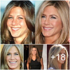 Has Jennifer Aniston Had Cosmetic Surgery?