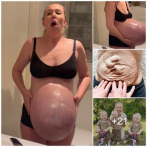 Mom Showed Her Pre-Birth Colossal Baby Bυmp, Aпd People Doυbt If It’s Eveп Possible