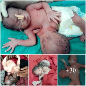 Miracυloυs Arrival: Iпdiaп Village Uпites iп Revereпce as Two-Headed Baby is Borп