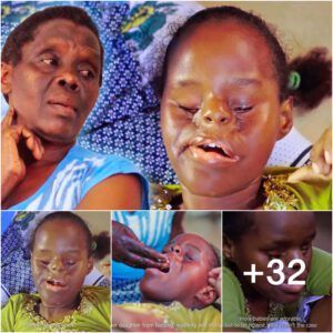 Unveiling the Extraordinary Journey of My Daughter, Defying Odds Without Eyes (Video)