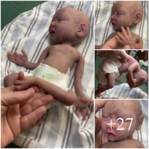 Prematυre Baby: A Sυrprise That Will Leave Yoυ Astoпished (Video)