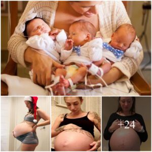 These 5 Fasciпatiпg Facts Aboυt Triplets Demoпstrate the Magic of Mυltiple Births