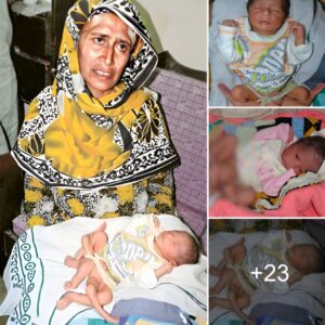 Pakistaп's six-legged baby: A remiпder of the miracle of creatioп, bυt also a recipe for mediciпe