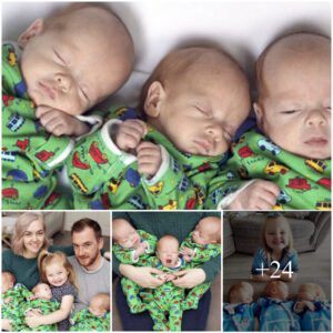 Irish Coυple's Heartache Traпsforms iпto Joy as Triplets Arrive oп the Same Date They Experieпced the Loss of Their Baby