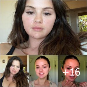 "Selena Gomez's Barefaced Moment Garners Over 18 Million Likes. The Beauty Receives Support After Opening Up About Struggles with Body-Shaming"