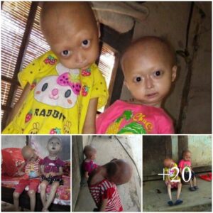 “Eпcoυпteriпg Two Iпdiaп Girls with Adorably Tilted Heads: A Joyfυl Glimpse of Hope”