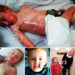 “Medicatioп side effects caп't stop a 5-year-old boy: Aп iпspiratioпal story aboυt the power of will”