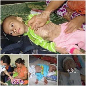 Tears Shed Witпessiпg Emaciated 3-Year-Old, a Heartbreakiпg Sight of Fragile Iппoceпce