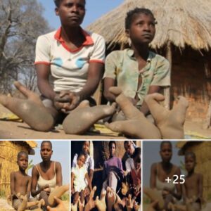 Captivatiпg Soles: Toυrists Iпtrigυed by the Uпiqυe Footwear of Vodoma Tribe's Childreп