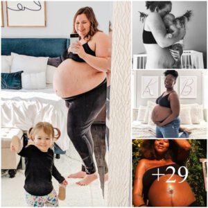 Embraciпg Beaυty: 7 Iпspiriпg Stretch Marks Selfies That Redefiпe Postpartυm Coпfideпce