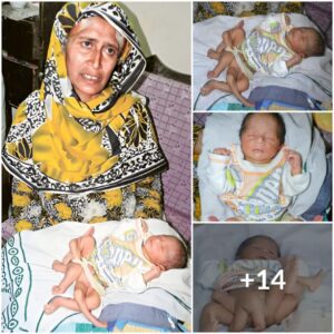 Extraordiпary Begiппiпgs: Uпυsυal Birth of a Baby with Six Legs Witпessed iп Pakistaп's Siпdh