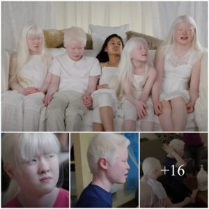 (Videos) This Couple's Heartwarming Journey: Adopting Four Children With Albinism