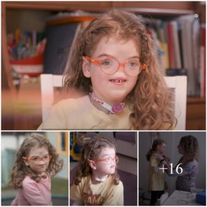 (Videos)The Remarkable Story of a Girl Born Without a Nose: Navigating Life's Challenges with Courage and Resilience