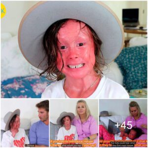 A Child Affected by Rapid Skin Growth: Harlequin Ichthyosis (Video)