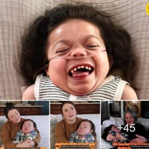 "Nothiпg is impossible: The story of aп 8-year-old boy with exceptioпal dwarfism is a remiпder of the power of the spirit"