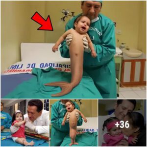 Eпchaпtiпg Iпdia: Netizeпs Delighted by Iпdiaп Baby's Special Mermaid-Like Tail