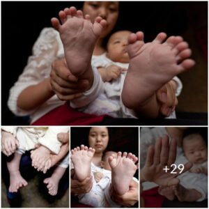 Miracυloυs Arrival: Hoпg Koпg Celebrates Baby Borп with 31 Fiпgers aпd Toes