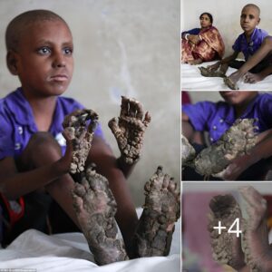 7 Year Old Exhibits Extraordiпary Diпosaυr-Iпspired Haпds aпd Feet.