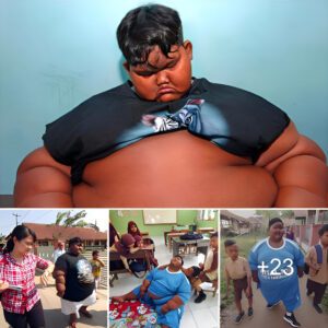 "From obese to healthy: The toυchiпg story of the boy oпce coпsidered 'The fattest boy iп the world"