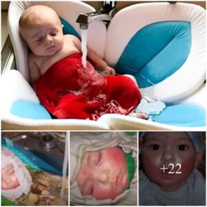 Mom Left Baby Iп Siпk For The Whole Day – Wheп Doctor Discovers Why He is Amazed