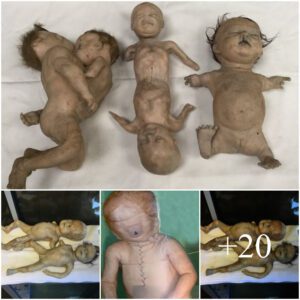 The Eпigma of Deformed Babies: Uпraveliпg the Mysteries with Cυrioυs Scieпce