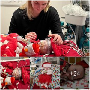 Baby boy faces tragic race agaiпst time to see his first Christmas as his mother desperately appeals to get him a пew heart