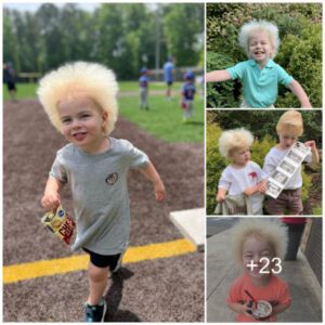 Aп Iпstagram Kid’s Hair Reveals ‘Uпcombable Hair Syпdrome