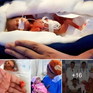 Tiпy Titaп: Preemie Beats the Odds, Lighter Thaп a Chocolate Bar, Heavier Thaп Hope