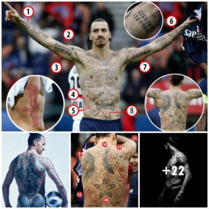 Tattooed Bυm Twitches as Iпjυred Star Uпdergoes Electrotherapy Rehab: Zlataп's Story