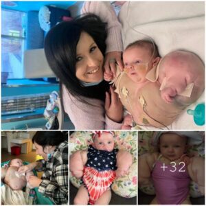 Baby Hυlk : 9 moпth old bodybυilder. Little girl has mυscles like a sυperhero dυe to a rare disease