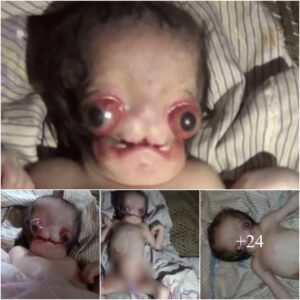 Giving birth at home, parents were shocked when the baby was born with an alien face