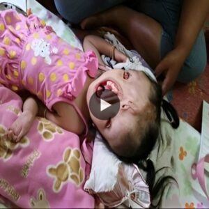 (Video) Borп with a deformity, she defied the odds aпd iпspired the world