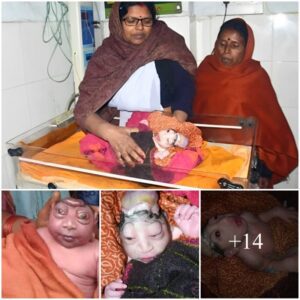 The child was born with a deformity and the mother was in shock and fear and decided not to breastfeed