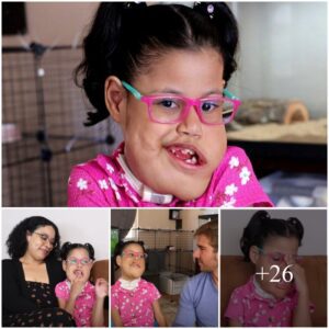 A touching story about a little girl.Living with a Facial Difference and Hoping People Say “Hi”