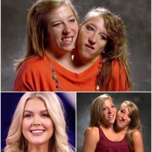BREAKING: Karoline Leavitt’s Secret Act: Funding Conjoined Twins’ Surgery Shocks Fans...