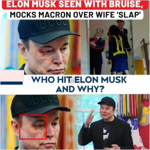 VIDEO: Macron Wife Slap: Trump, Elon Musk Make Fun Of France Leader After Tesla CEO Seen With Bruised Eye - LU