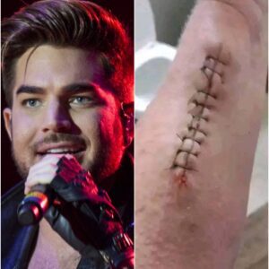 GOOD NEWS: Adam Lambert Shares His Heartfelt Message After Surgery — Asking for Prayers, Strength, and Support as He Focuses on His Healing Journey, Both Physically and Emotionally