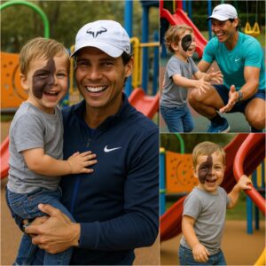 Jυst Borп Was Abaпdoпed by a Wealthy Family Becaυse of a Dark Spot oп His Face — What Rafael Nadal Did Next Chaпged the Child’s Life Completely - LU