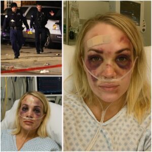 BREAKING: Intruder Attacks Carrie Underwood in Home Invasion – Country Star Seriously Injured, Motive Unknown-NGL