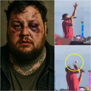 COUNTRY CHAOS: Jelly Roll STRUCK in the Face by Flying Object During Live Concert — Fans Screamed, Show Stopped Cold, and Security Swarmed the Stage!