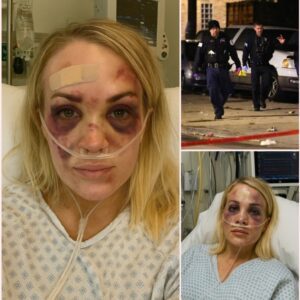 BREAKING: Terrifying Home Invasion Leaves Carrie Underwood Seriously Injured — Armed Intruder Storms Country Queen’s Property Overnight, Motive a Mystery as Police Launch Urgent Investigation