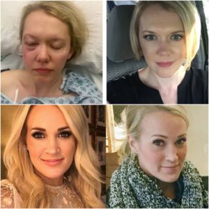 “What Happened to Her Face?!” — Carrie Underwood’s Unrecognizable Appearance at Red Carpet Event Fuels Plastic Surgery Speculation and Leaves Fans Heartbroken Over Her Changing Looks
